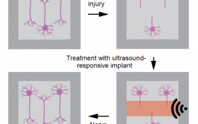 Development of an ultrasound-responsive implant to treat spinal cord injury